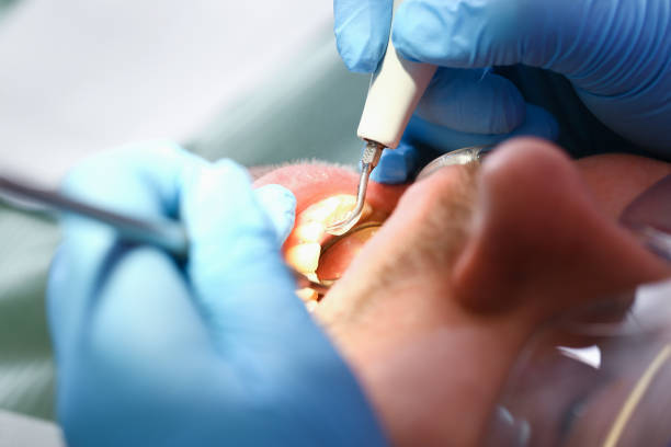 Best Urgent Tooth Repair  in Bright, IN