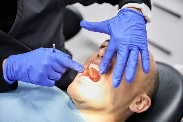 Best Teeth Whitening  in Bright, IN