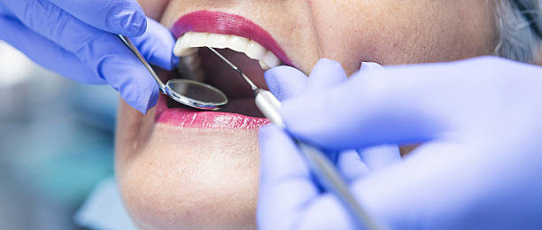 Best Dentist for Tooth Abscess  in Bright, IN
